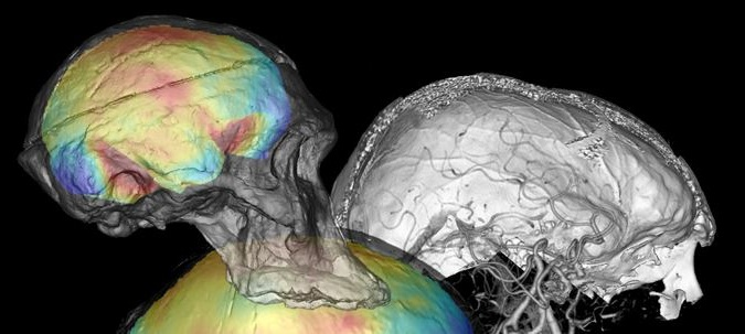 Exemplo de estudo paleoneurológico que utiliza tomografias para análise das feições neurológicas fossilizadas de hominíneos ancestrais. Crédito: Center for Cognitive Archaeology, UCCS.